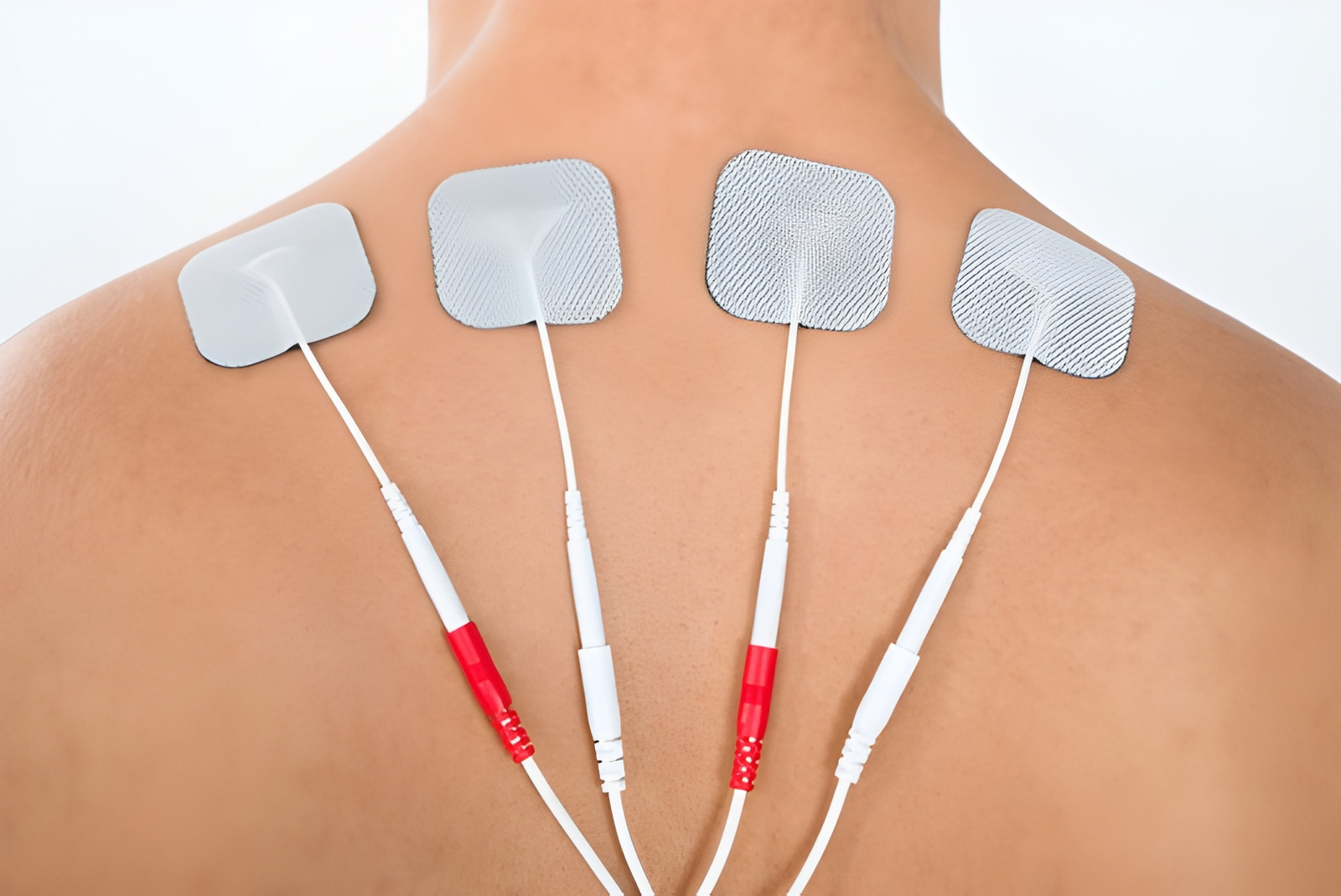 Electrotherapy